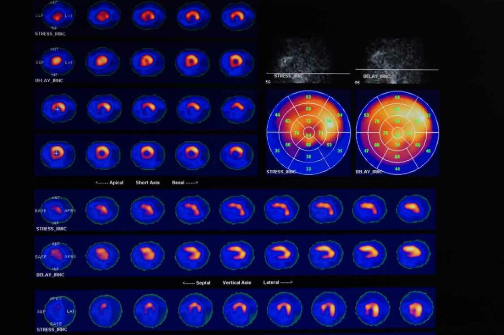 Myokardszintigraphie durch die Ordination Josefstadt